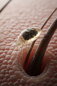 Photo: The Tiny Face Mites That Have Lived on Humans for Millions of Years