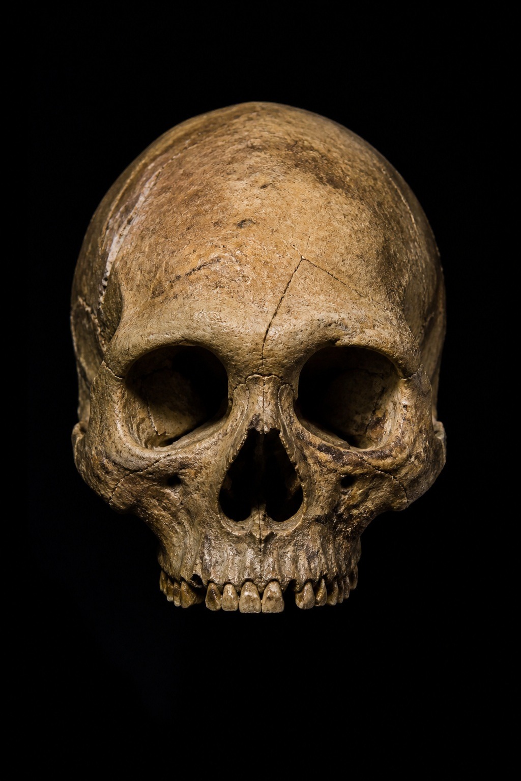 The fossilised Herto cranium BOU-VP-16/1, a robust modern human skull with a high rounded braincase, lit dramatically against a dark background