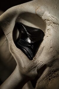 A small, glossy black fragment of vitrified brain matter resembling obsidian, resting against the pale bone of a Roman-era skull cavity